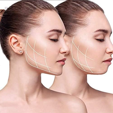 Dispozitiv de Tonifiere Faciala,  din Silicon, Corectare Mandibula/Maxilar, Gri